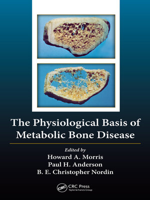 cover image of The Physiological Basis of Metabolic Bone Disease